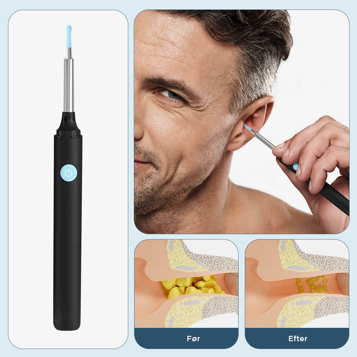 [50% FRA] - Stunor™ - Apparat Til Fjernelse Af Ørevoks