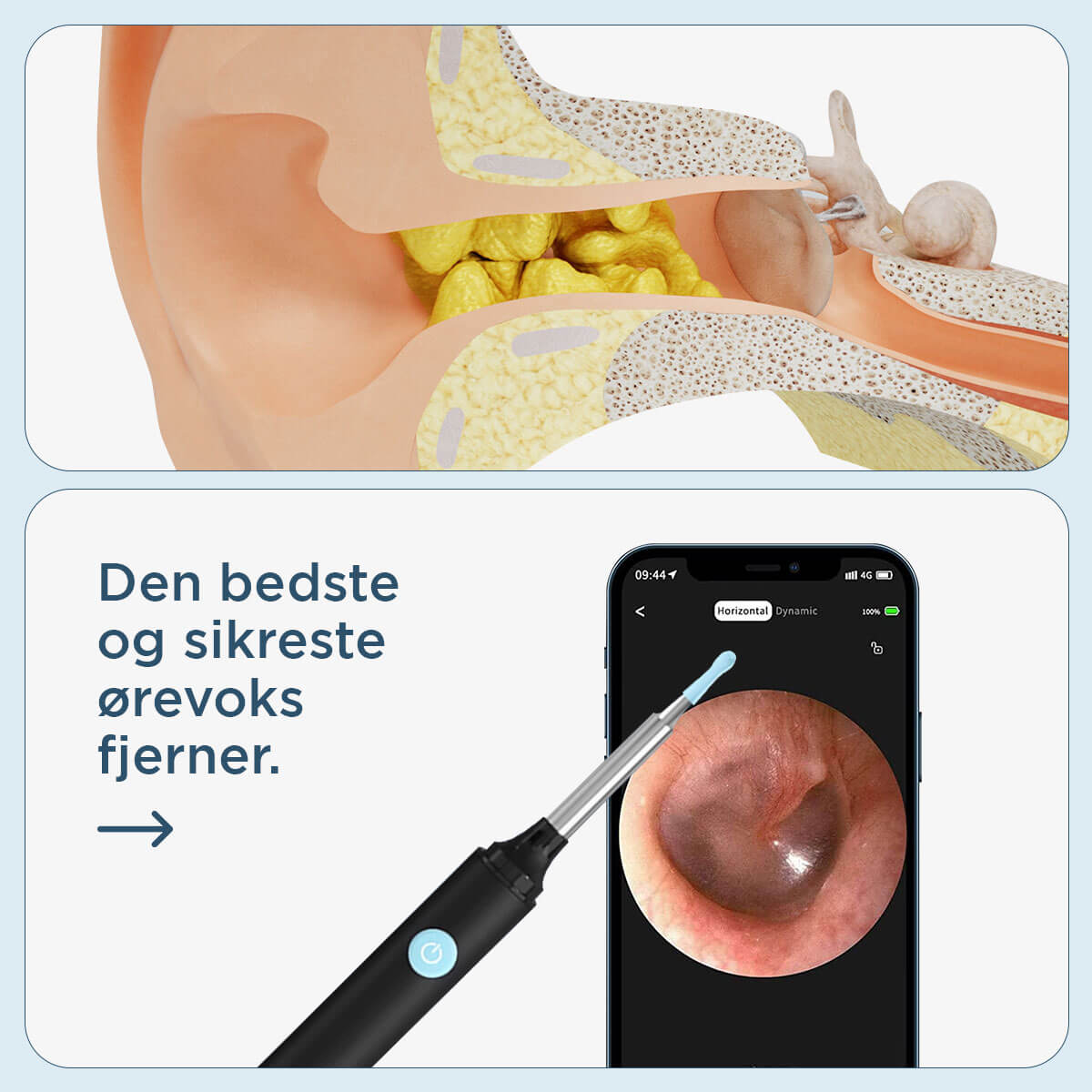 [50% FRA] - Stunor™ - Apparat Til Fjernelse Af Ørevoks