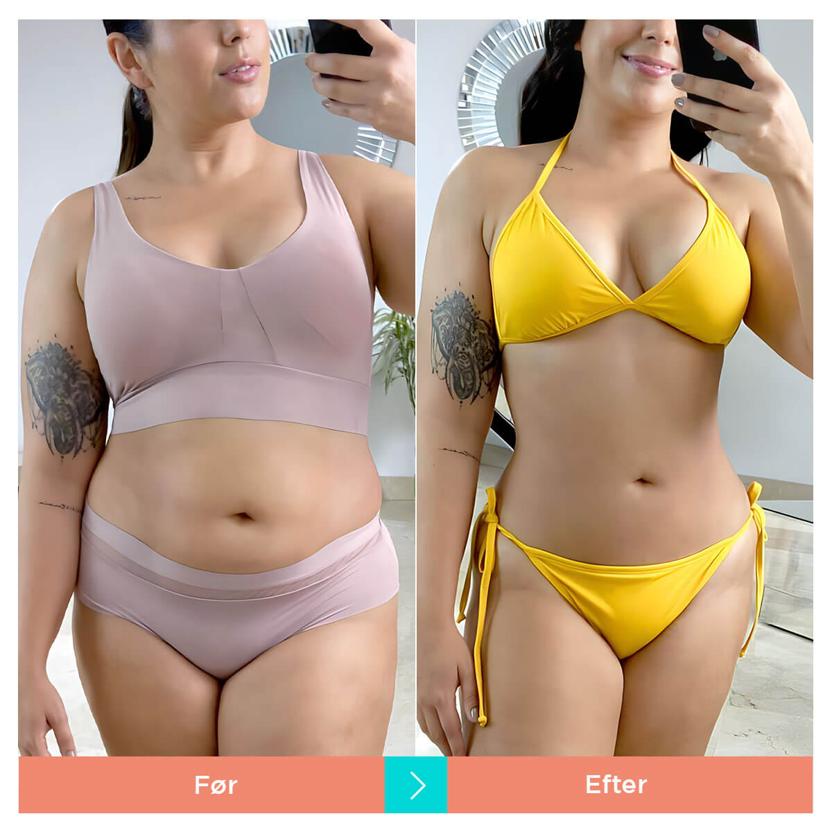 [50% RABAT] CONNECY™ Cellulite Sculpt Massageapparat