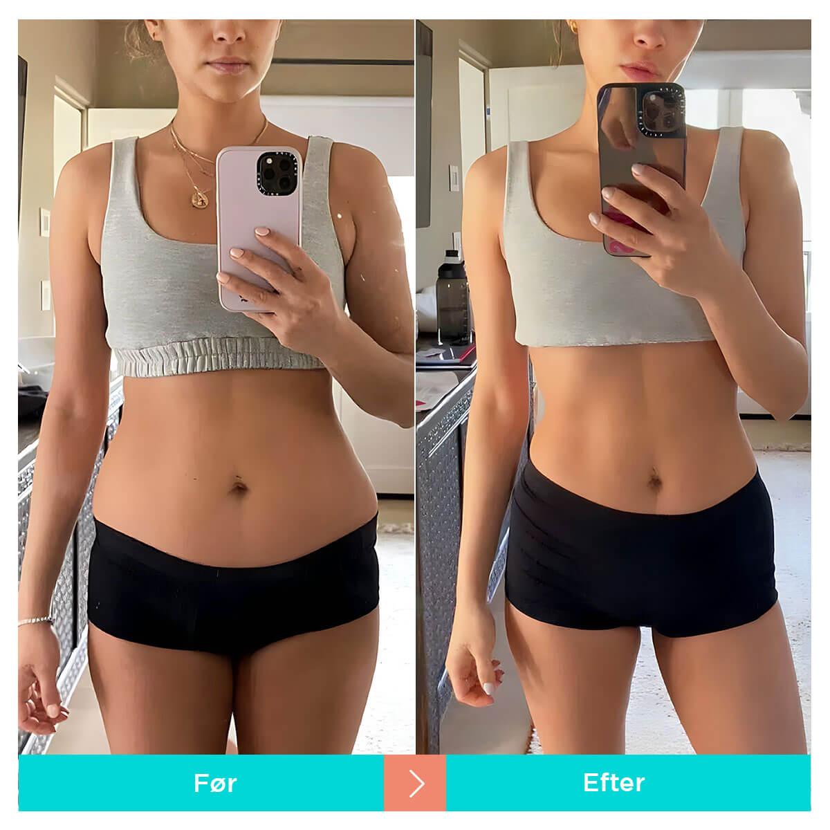 [50% RABAT] CONNECY™ Cellulite Sculpt Massageapparat