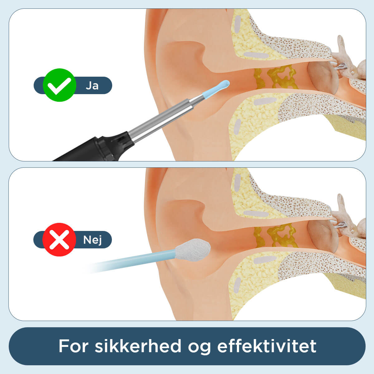 [50% FRA] - Stunor™ - Apparat Til Fjernelse Af Ørevoks