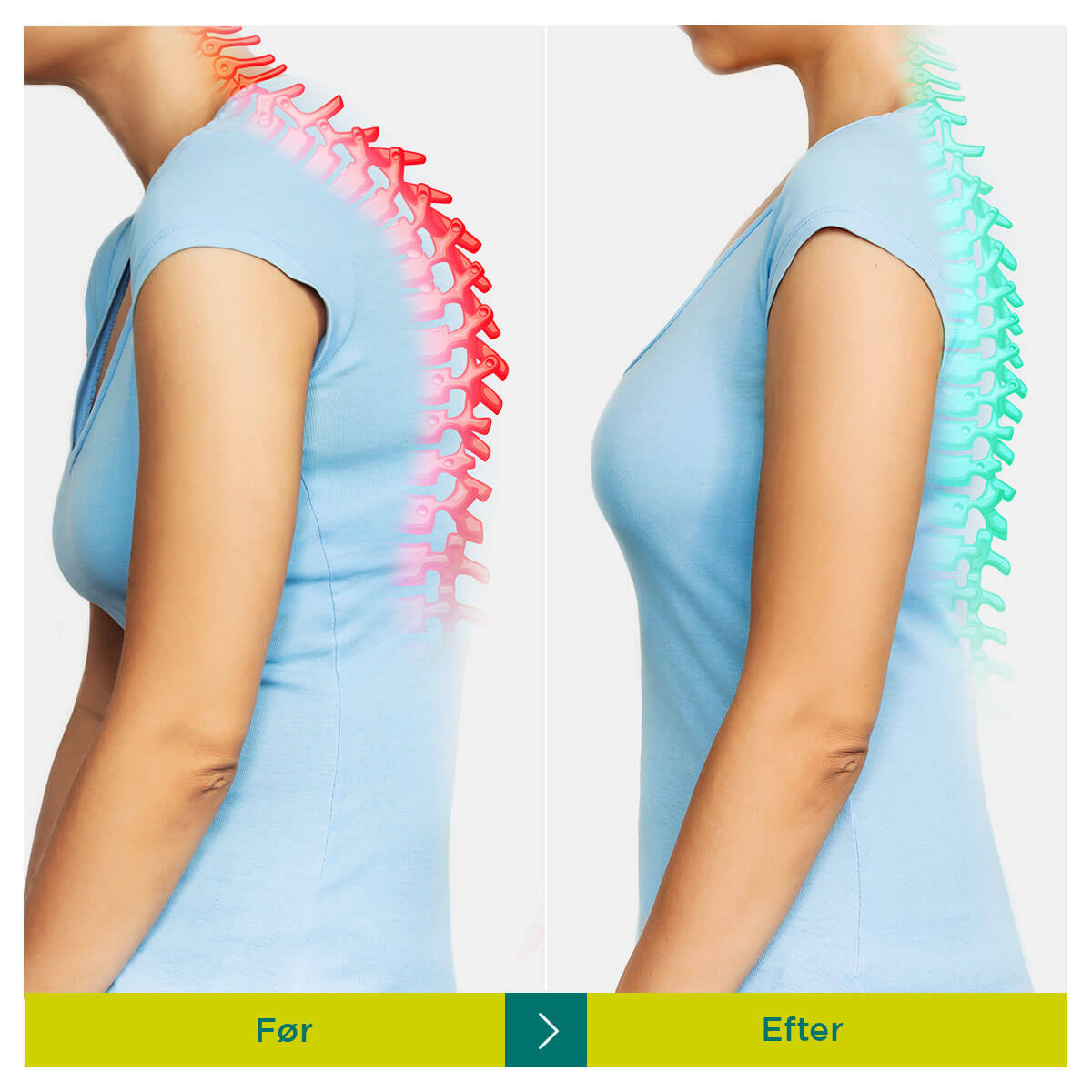 [50% OFF] Dr.Korrektor - Kropsholdnings Korrektor