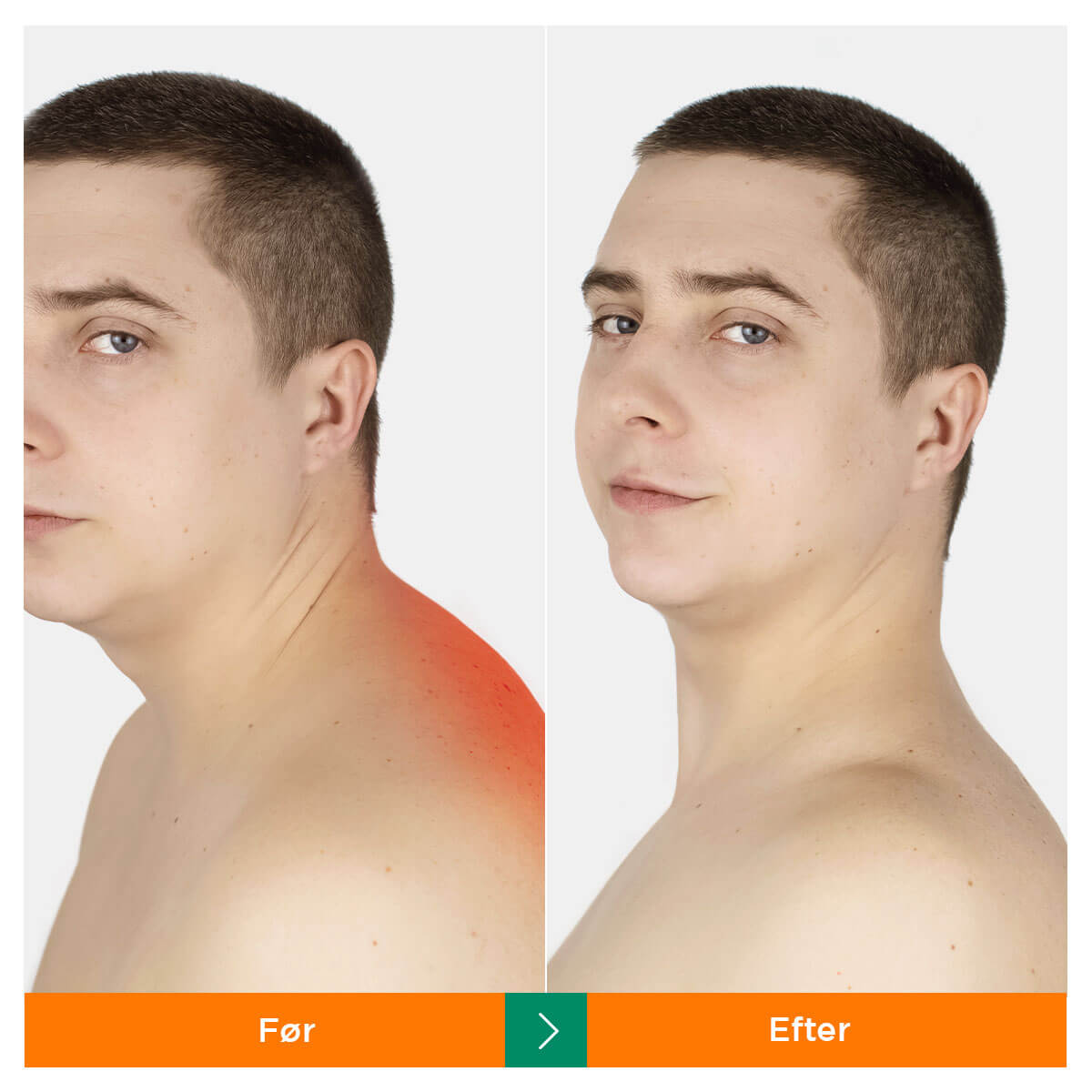 [50% RABAT] Dr.Nakke Aflastning - Digitalt Nakkemassageapparat