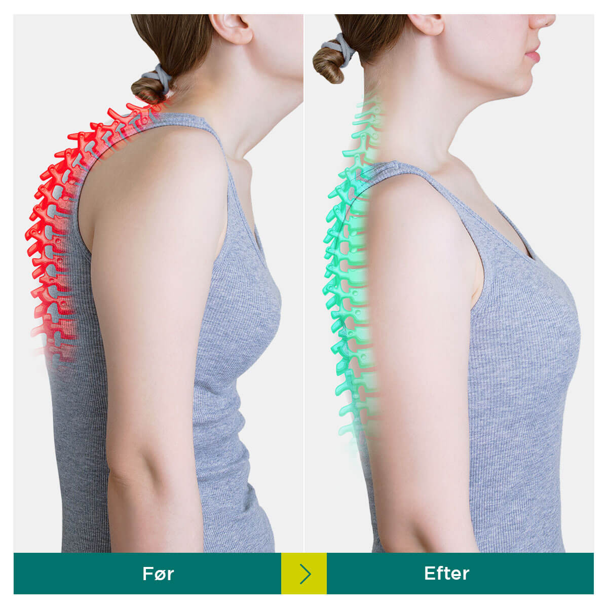 [50% OFF] Dr.Korrektor - Kropsholdnings Korrektor