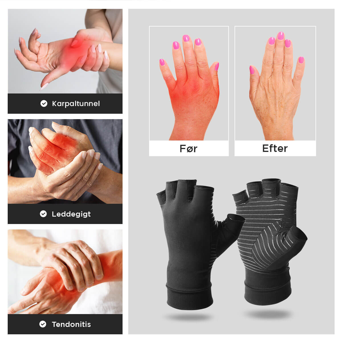 [50% OFF] Dr.Karpaltunnel ™ Smertelindring kobber kompressionshandsker