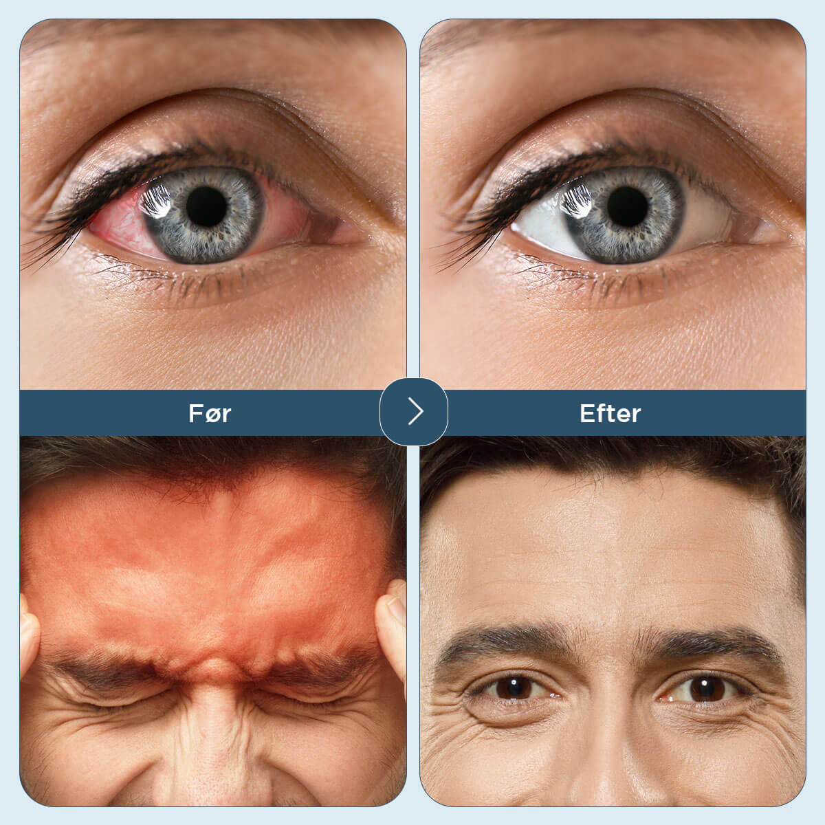 [50% FRA] Dr Relief - EMS øjenmassageapparat